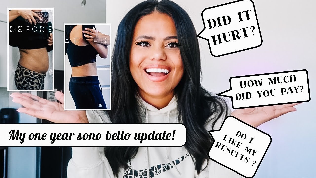 Is Sono Bello Covered by Insurance?